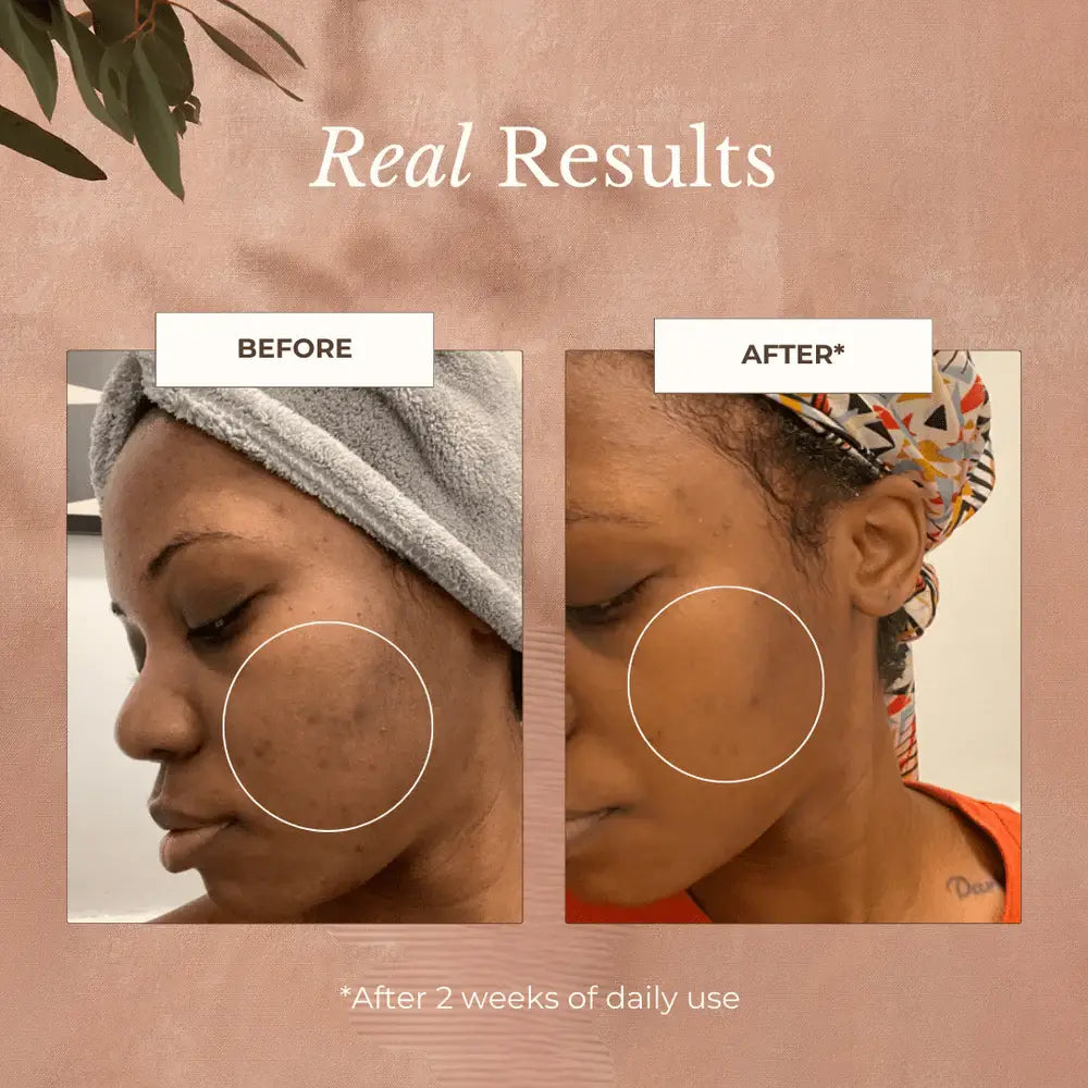 Neroli Clarifying Complexion Mist